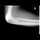 Osseous bridging of the left elbow: X-ray - Plain radiograph